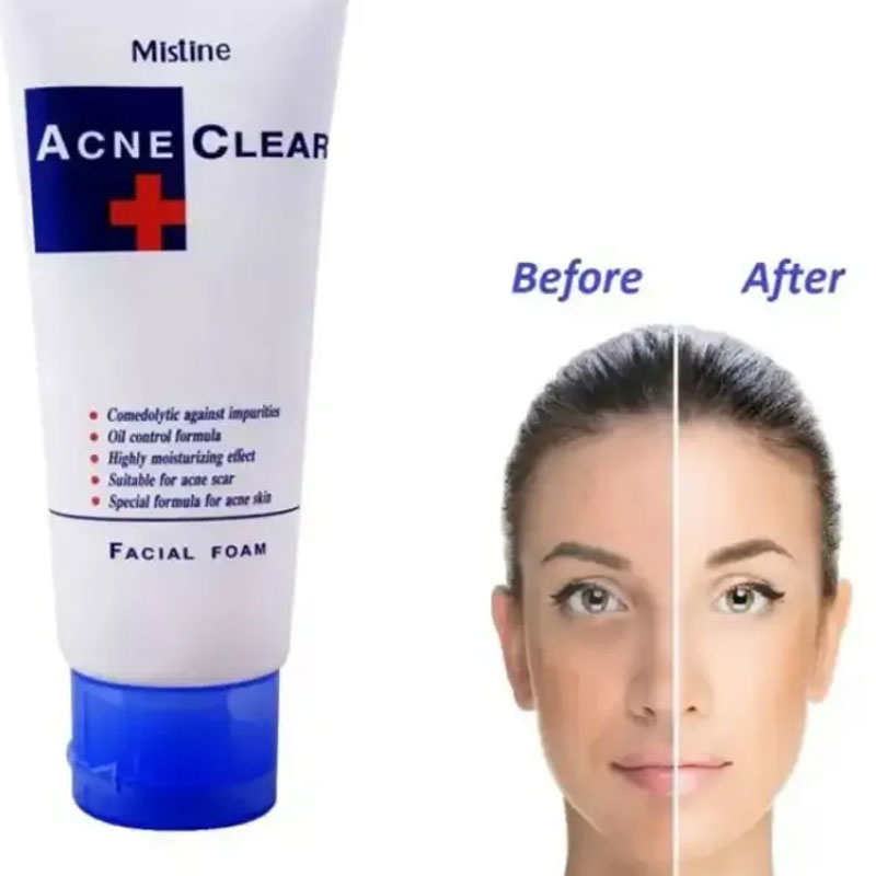 Mistine Acne Clear Plus Facial Foam Face Wash 85ml